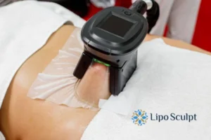 Cryolipolysis Helping You Getting that Perfect Summer Body 3 Cryolipolysis Apsley can give you the best summer body - contact us today!