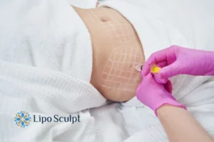 Are The Results From Aqualyx Permanent? 1 Do you want to know how long Aqualyx Apsley results last?
